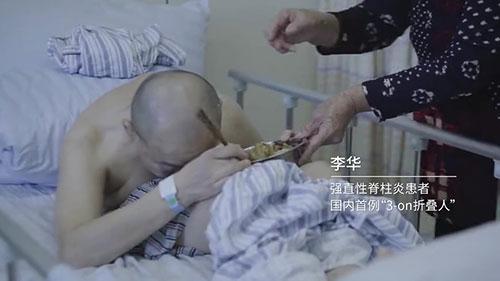 身體被敲斷4次的折疊人出院，打開折疊人生(圖2)