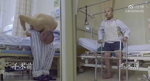 身體被敲斷4次的折疊人出院，打開折疊人生(圖15)