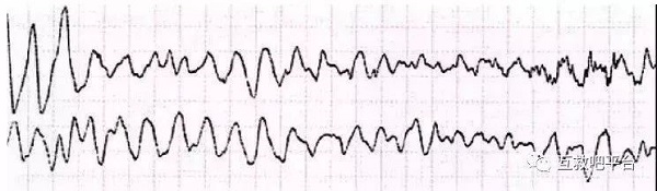 救命神器AED有多重要——你認(rèn)識(shí)它嗎？(圖5)